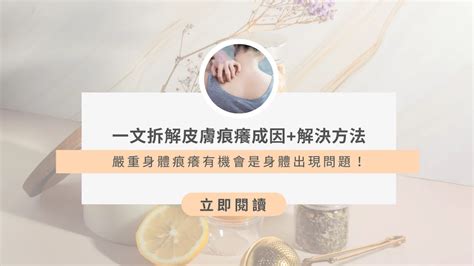 皮膚無故痕癢|皮膚痕癢解決方法｜皮膚痕癢原因+解決方法實測！擊 